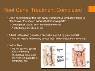 Root Canal Treatment Completed
  Upon completion of the root canal treatment, a temporary filling is
   placed over the sealed canals that has two parts:
    Cotton pellet soaked in an antibacterial solution
    A solid temporary filling on top


  A final restoration (usually a crown) is placed by your dentist
    This will restore functionality to your tooth and protect it from fracturing

  Follow Ups
    We will see you back to
     evaluate healing
    The healing bone takes
     one year (on average) to
     completely heal
 