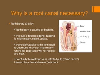 Why is a root canal necessary?
Tooth Decay (Cavity)

    Tooth decay is caused by bacteria.

    The pulp’s defense against bacteria
    is inflammation, called pulpitis.

    Irreversible pulpitis is the term used
    to describe the level of inflammation
    where the pulp tissue will not recover
    and heal.

    Eventually this will lead to an infected pulp (“dead nerve”),
    followed by a dental abscess (infection).
 