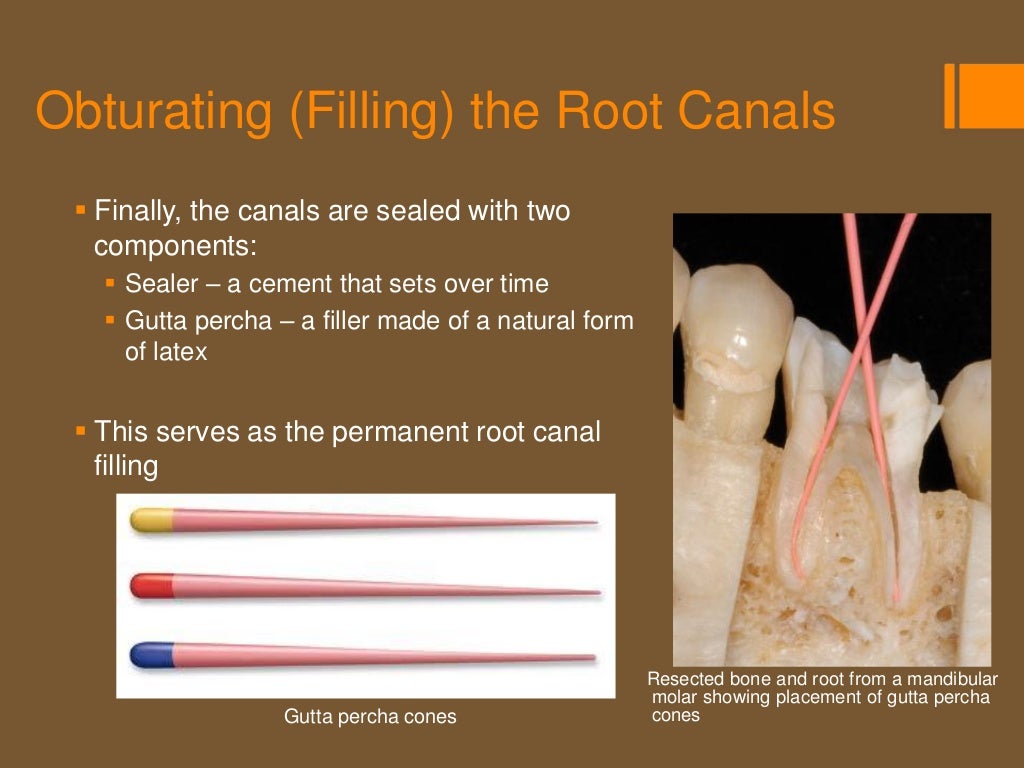 Root Canal Treatment
