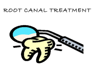 ROOT CANAL TREATMENT 