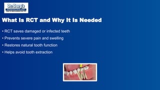 Root Canal Treatment Cost in Delhi Explained by Dr. Garg’s ...
