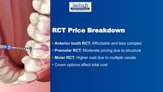 Rct Explained Root Canal Treatment Cost in Delhi Explained by Dr. Garg’s ...