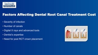 Root Canal Treatment Cost in Delhi Explained by Dr. Garg’s ...