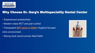 Root Canal Treatment Cost in Delhi Explained by Dr. Garg’s ...