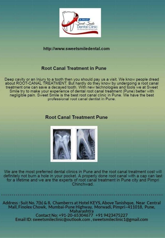 Root Canal Treatment in Pune Root Canal Treatment cost in Pune