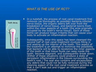 Second Stage Rct Root canal treatment slides | PPT