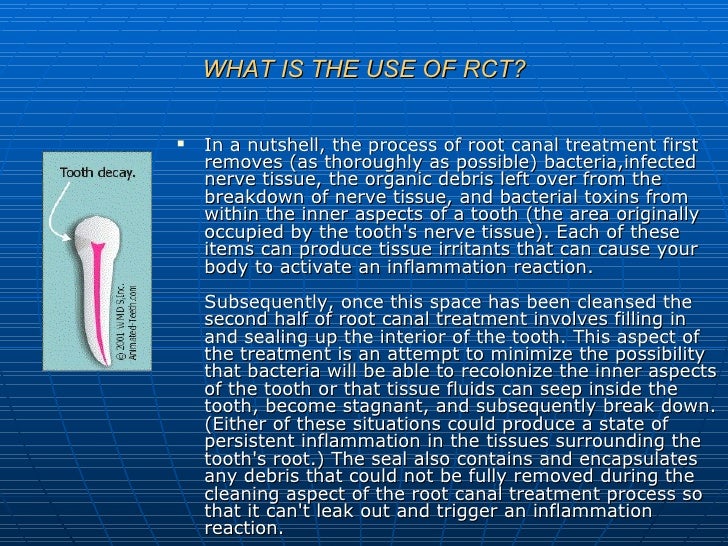 Root canal treatment slides