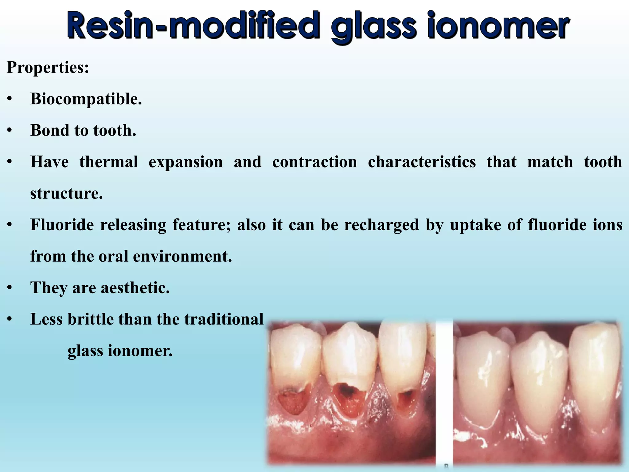 Properties:
• Biocompatible.
• Bond to tooth.
• Have thermal expansion and contraction characteristics that match tooth
structure.
• Fluoride releasing feature; also it can be recharged by uptake of fluoride ions
from the oral environment.
• They are aesthetic.
• Less brittle than the traditional
glass ionomer.
 