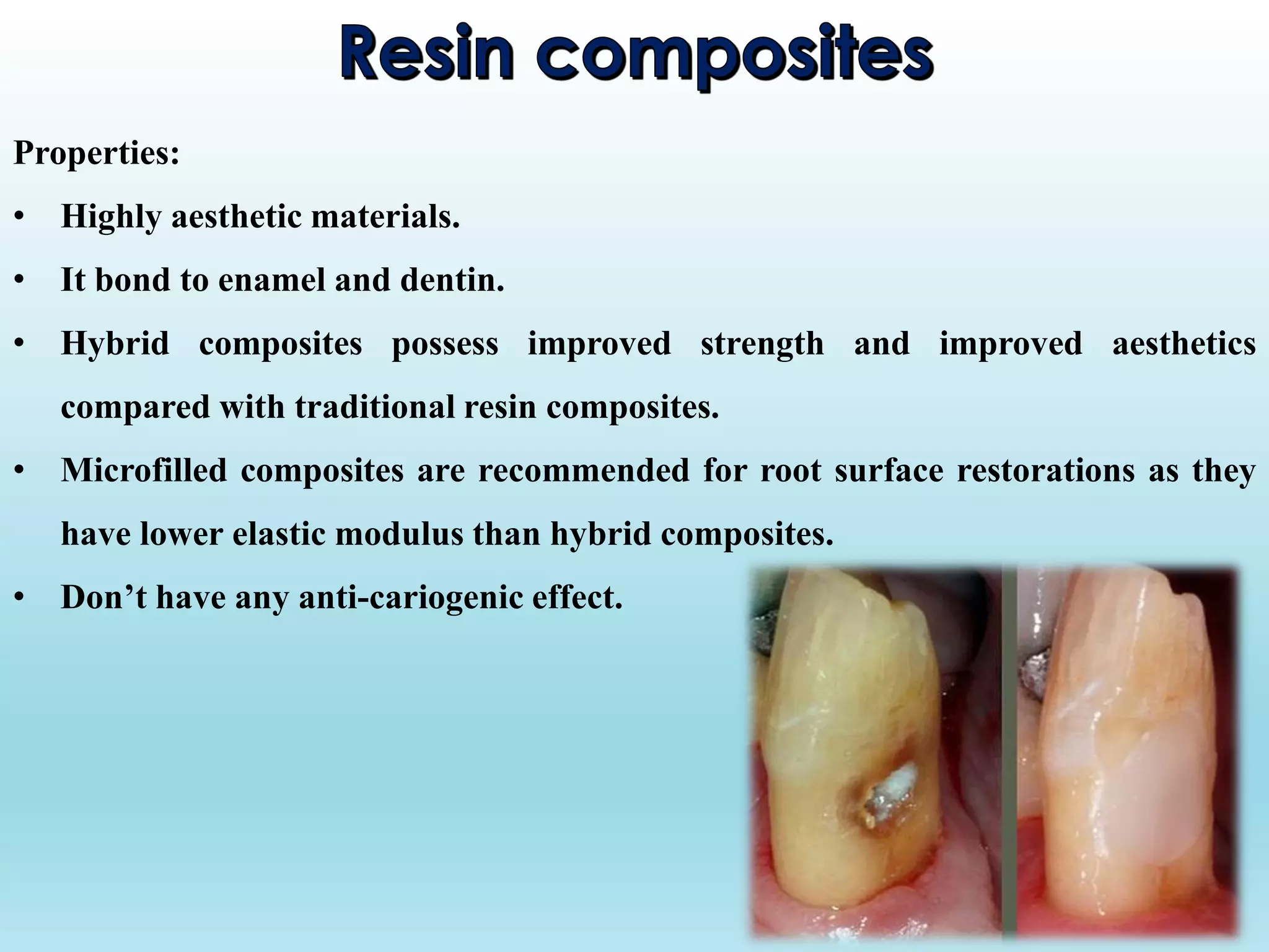 Properties:
• Highly aesthetic materials.
• It bond to enamel and dentin.
• Hybrid composites possess improved strength and improved aesthetics
compared with traditional resin composites.
• Microfilled composites are recommended for root surface restorations as they
have lower elastic modulus than hybrid composites.
• Don’t have any anti-cariogenic effect.
 
