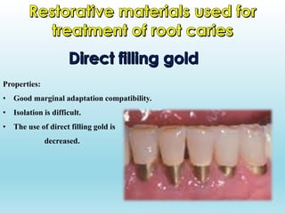 Properties:
• Good marginal adaptation compatibility.
• Isolation is difficult.
• The use of direct filling gold is
decreased.
 