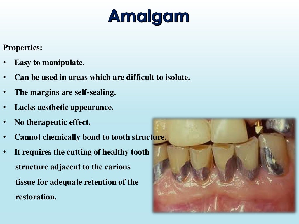 Root Caries