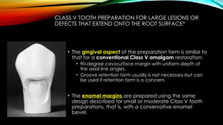 Root caries and class Vclass five tooth.pptx