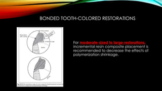 Root caries and class Vclass five tooth.pptx