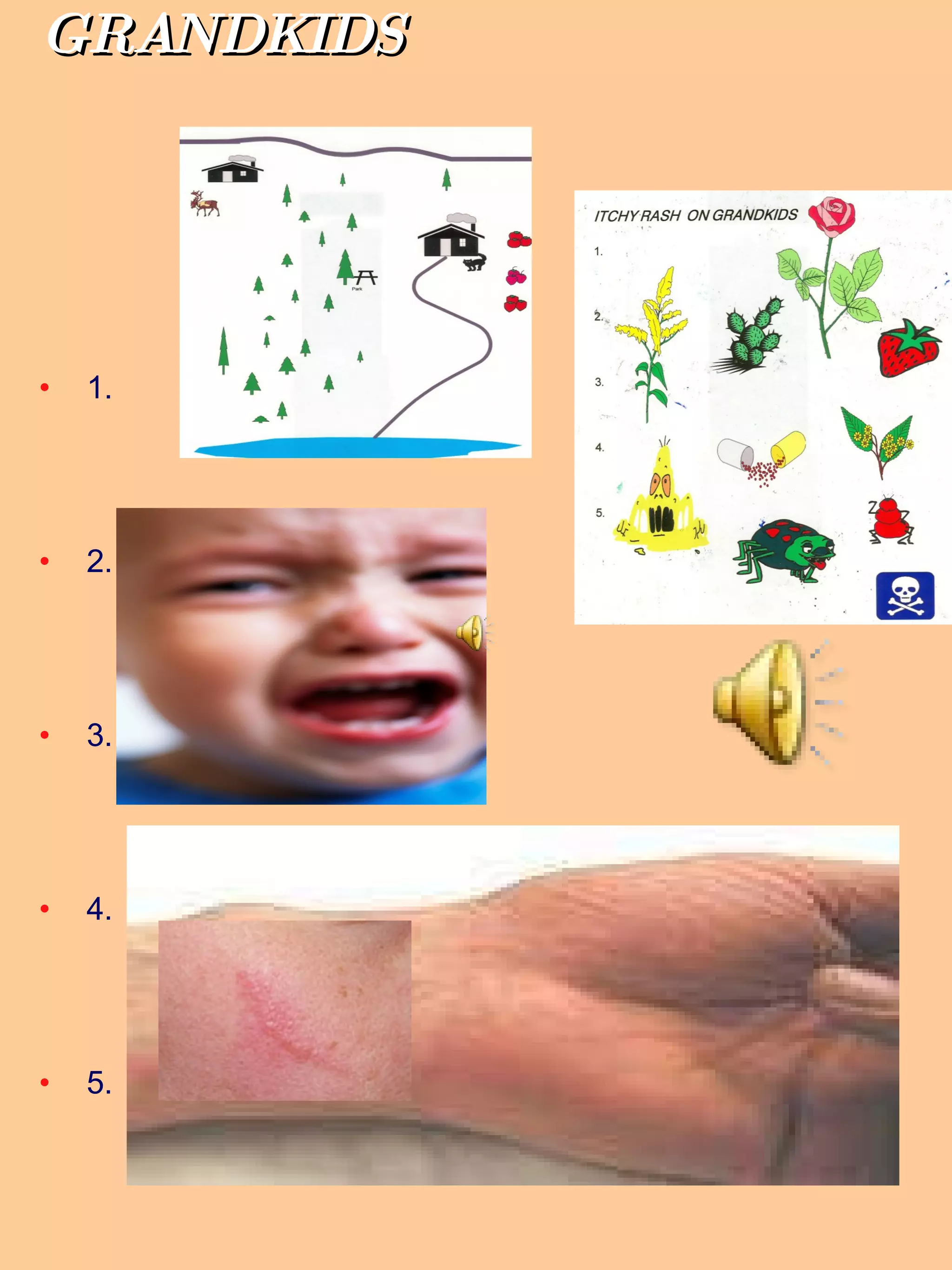 ITCHY RASH   ON GRANDKIDS 1. 2. 3. 4. 5. 