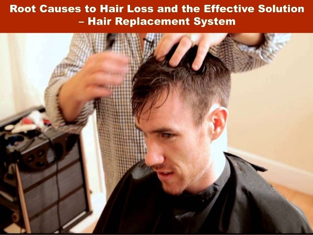 Root Causes To Hair Loss And The Effective Solution Hair Replacemen