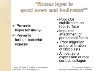 Poor clot
stabilization on
root surface
Impaired
attachment of
periodontal fibers
Poor migration
and proliferation
of fibroblasts
Almost zero
expression of root
surface collagen
*Endodontics, Volume 1
edited by John Ide Ingle, Leif K. Bakland
Prevents
hypersensitivity**
Prevents
further bacterial
ingress**
**Rusin RP, Agee K, Suchko M, Pashley DH.
Dent Mater. 2010 Jun;26(6):600-7.
 