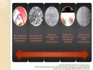 Goes P, Melo IM, Dutra CS, Lima AP, Lima V.
Effect of alendronate on bone-specific alkaline phosphatase on periodontal bone
loss in rats. Arch Oral Biol. 2012 Nov;57(11):1537-44.
 