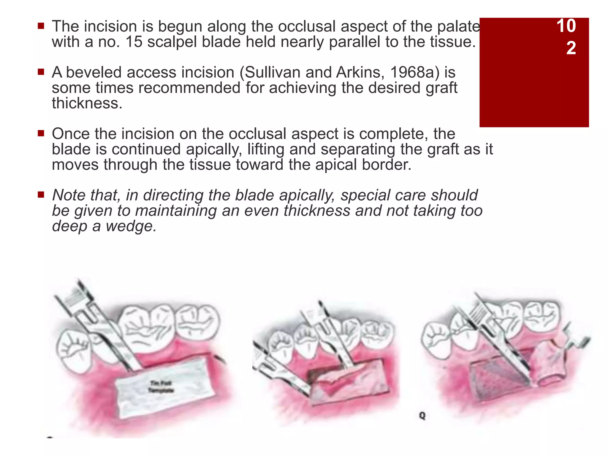  The incision is begun along the occlusal aspect of the palate
with a no. 15 scalpel blade held nearly parallel to the tissue.
 A beveled access incision (Sullivan and Arkins, 1968a) is
some times recommended for achieving the desired graft
thickness.
 Once the incision on the occlusal aspect is complete, the
blade is continued apically, lifting and separating the graft as it
moves through the tissue toward the apical border.
 Note that, in directing the blade apically, special care should
be given to maintaining an even thickness and not taking too
deep a wedge.
10
2
 