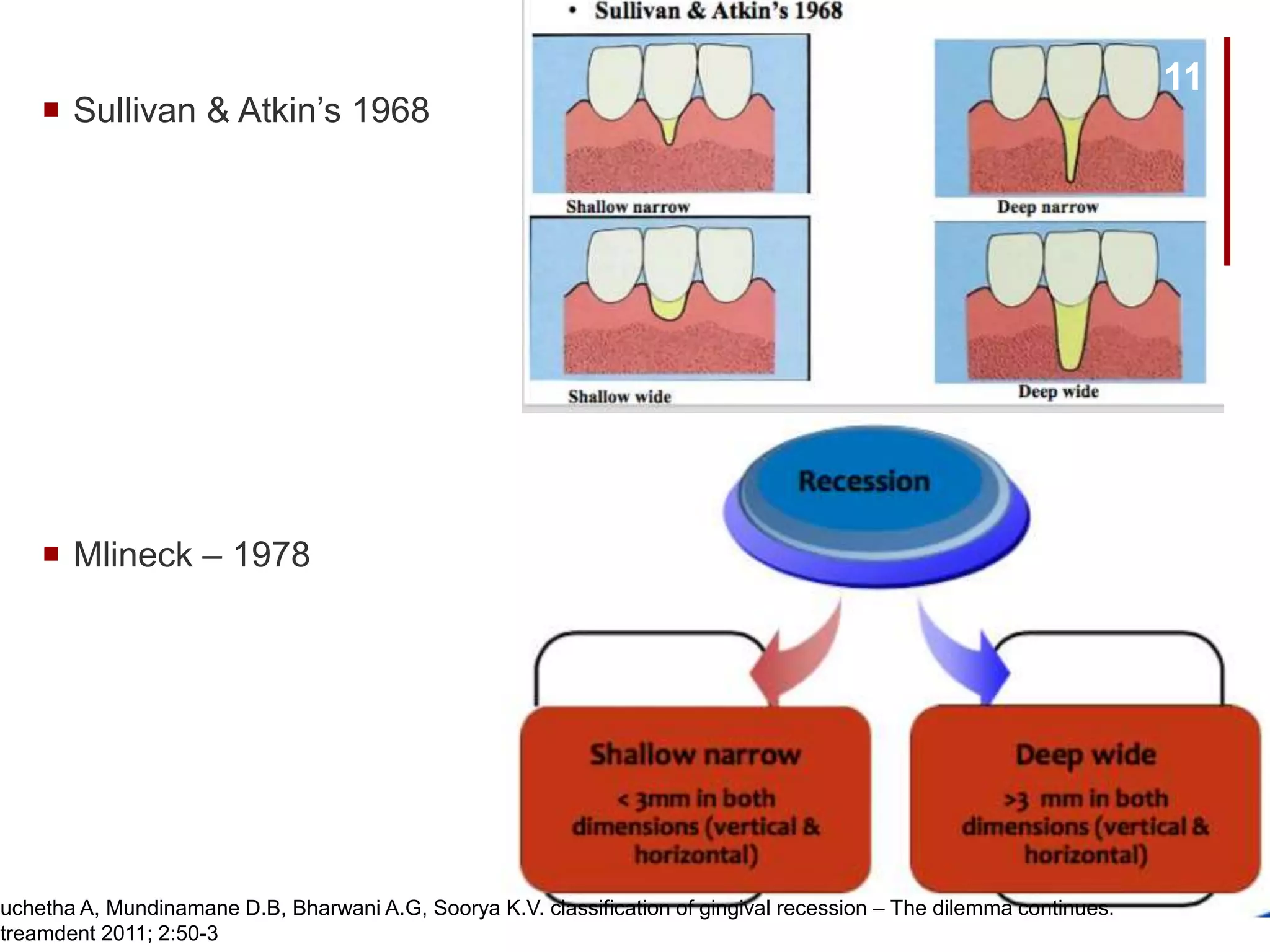  Sullivan & Atkin’s 1968
 Mlineck – 1978
Suchetha A, Mundinamane D.B, Bharwani A.G, Soorya K.V. classification of gingival recession – The dilemma continues.
Streamdent 2011; 2:50-3
11
 