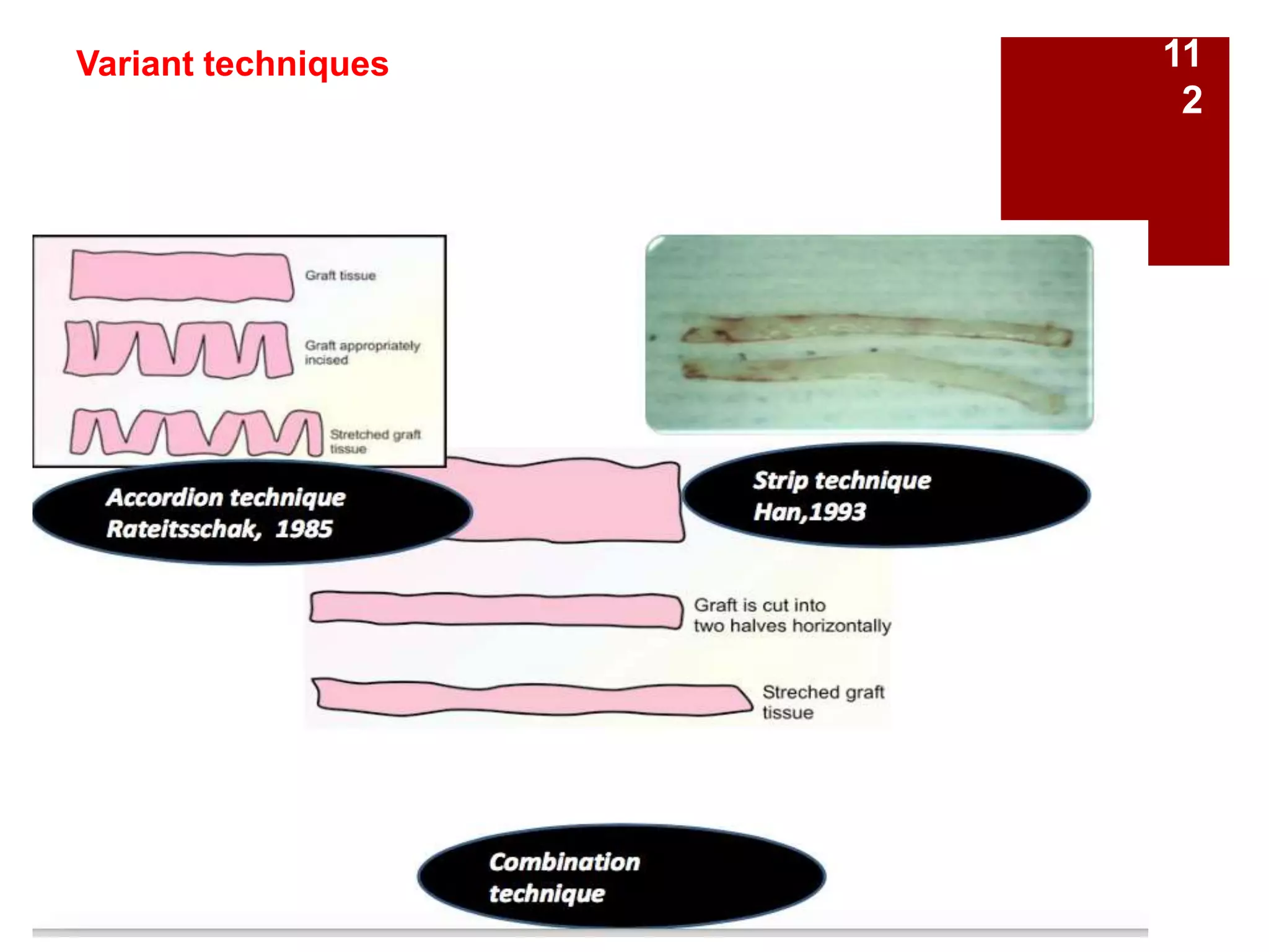 Variant techniques 11
2
 