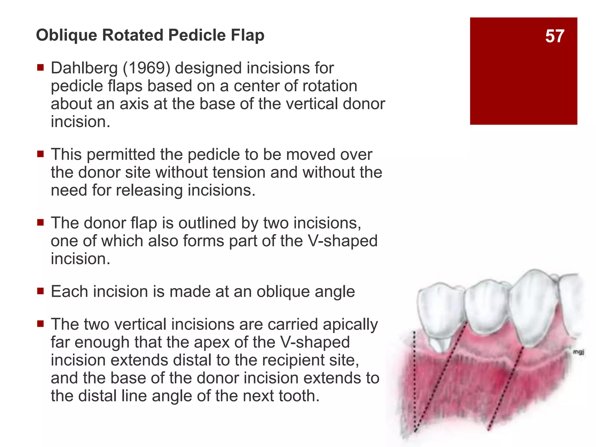 Oblique Rotated Pedicle Flap
 Dahlberg (1969) designed incisions for
pedicle flaps based on a center of rotation
about an axis at the base of the vertical donor
incision.
 This permitted the pedicle to be moved over
the donor site without tension and without the
need for releasing incisions.
 The donor flap is outlined by two incisions,
one of which also forms part of the V-shaped
incision.
 Each incision is made at an oblique angle
 The two vertical incisions are carried apically
far enough that the apex of the V-shaped
incision extends distal to the recipient site,
and the base of the donor incision extends to
the distal line angle of the next tooth.
57
 