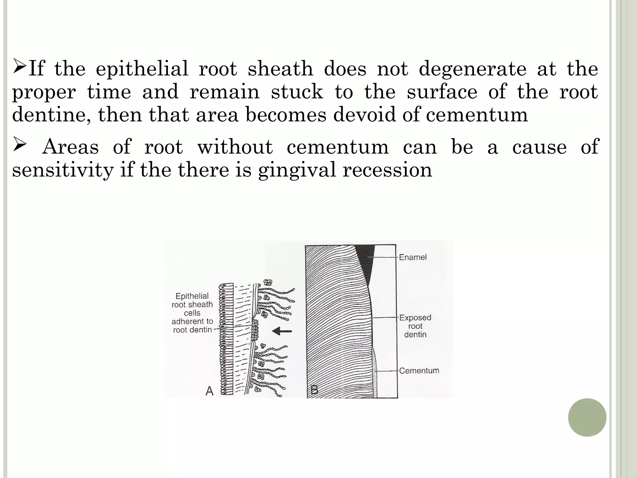 If the epithelial root sheath does not degenerate at the
proper time and remain stuck to the surface of the root
dentine, then that area becomes devoid of cementum
 Areas of root without cementum can be a cause of
sensitivity if the there is gingival recession
 