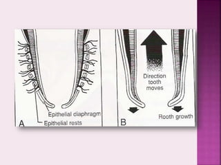 Root formation