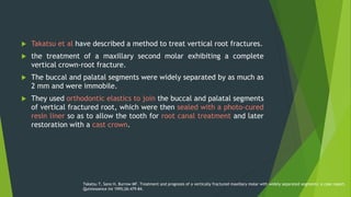  Trope et al have described the treatment of a vertically fractured
upper left second molar.
 The two fragments were ext...