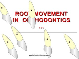 ROOT MOVEMENTROOT MOVEMENT
IN ORTHODONTICSIN ORTHODONTICS
……
www.indiandentalacademy.com
 