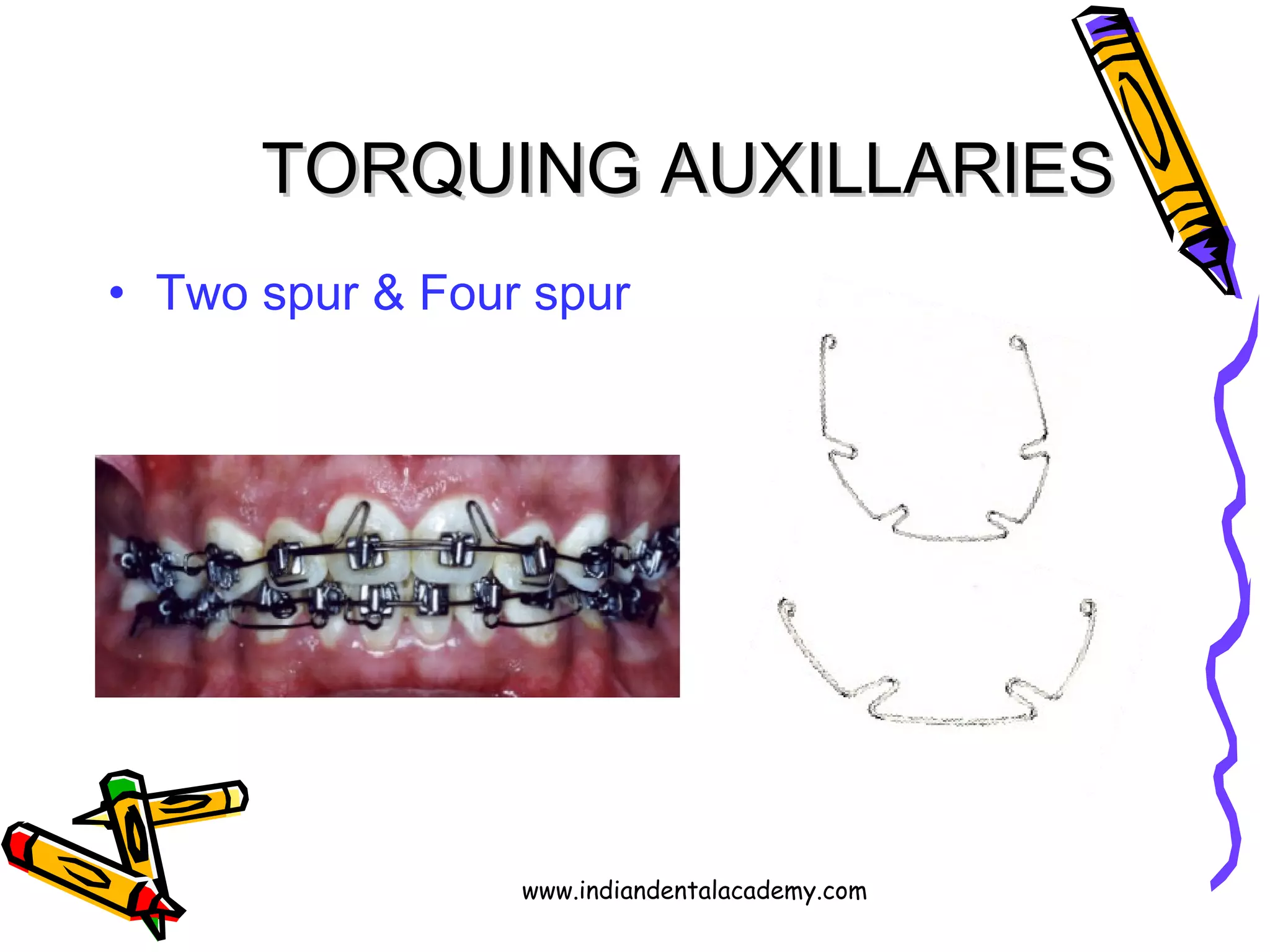 TORQUINGTORQUING AUXILLARIESAUXILLARIES
• Two spur & Four spur
www.indiandentalacademy.com
 