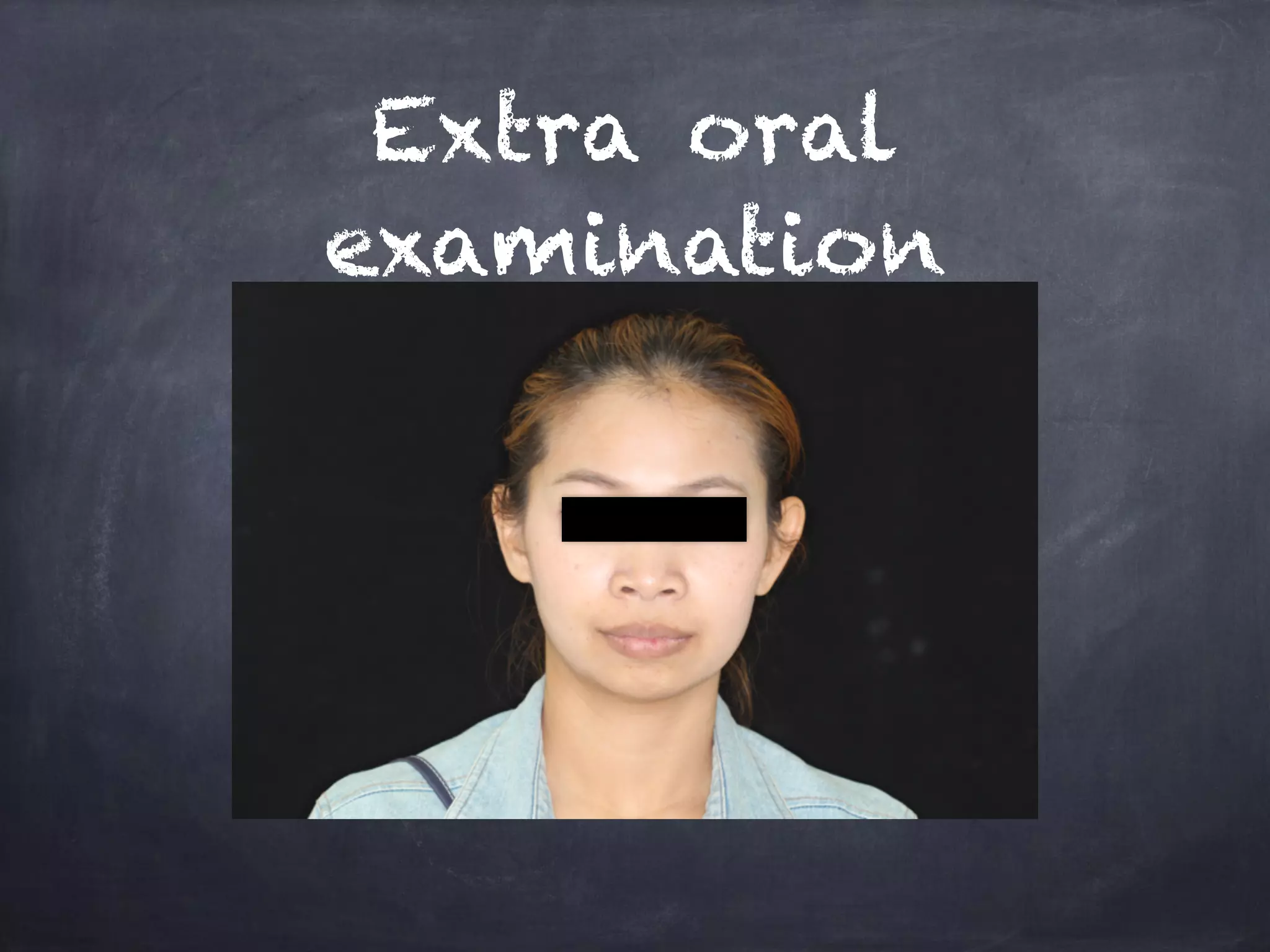 Extra oral 
examination 
 