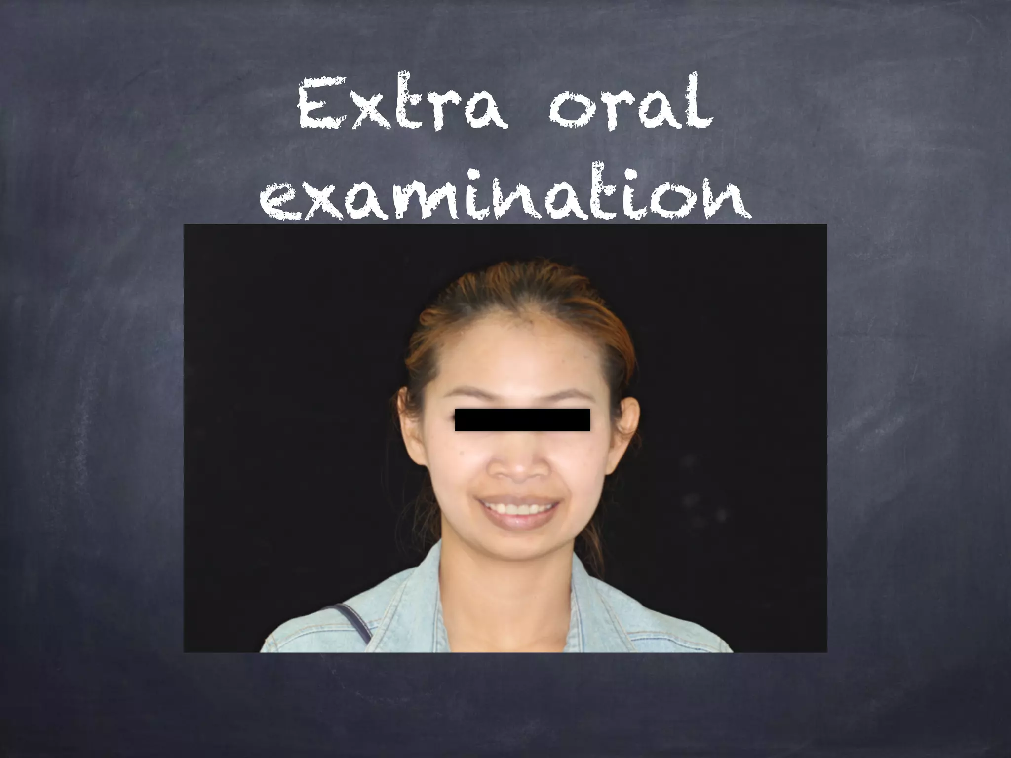 Extra oral 
examination 
 