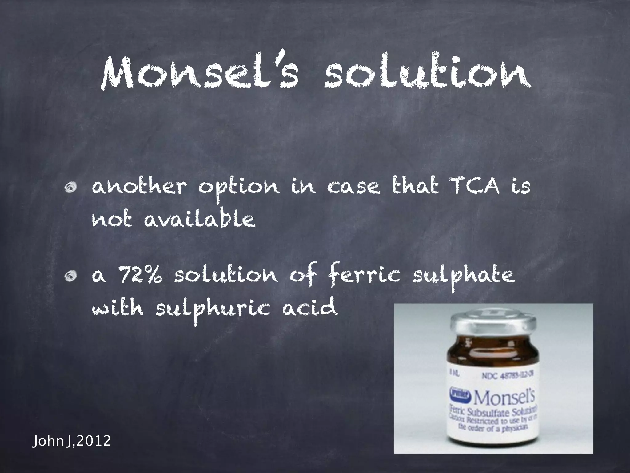 Monsel’s solution 
another option in case that TCA is 
not available 
a 72% solution of ferric sulphate 
with sulphuric acid 
John J,2012 
 