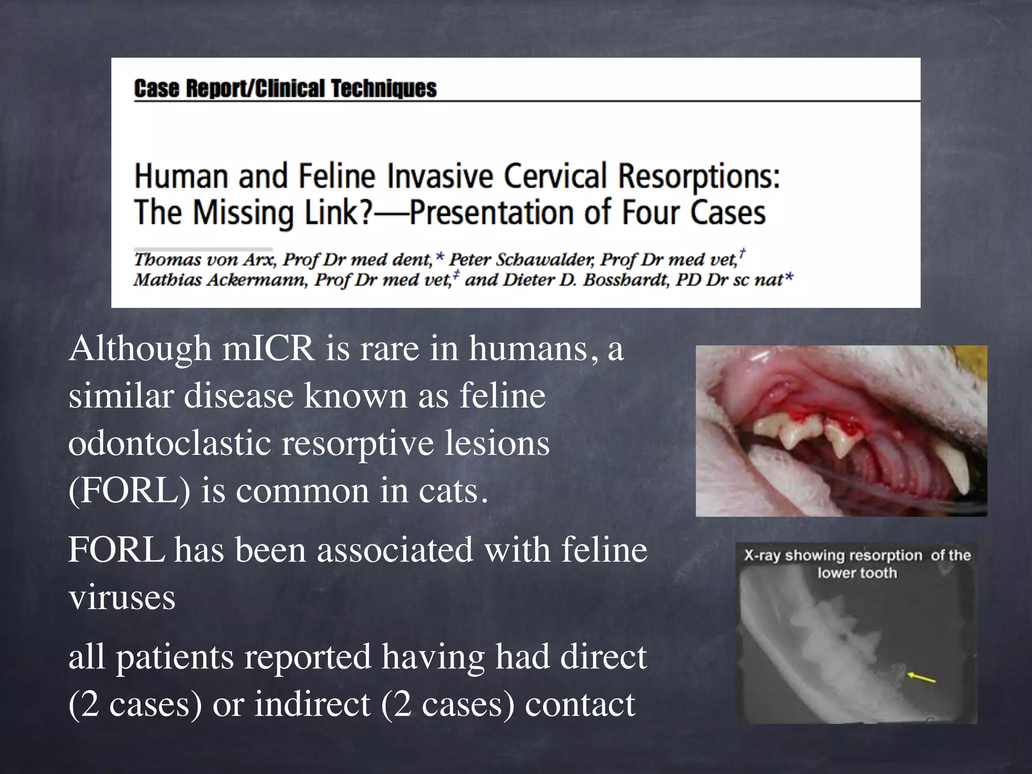 Although mICR is rare in humans, a 
similar disease known as feline 
odontoclastic resorptive lesions 
(FORL) is common in cats. 
FORL has been associated with feline 
viruses 
all patients reported having had direct 
(2 cases) or indirect (2 cases) contact 
 