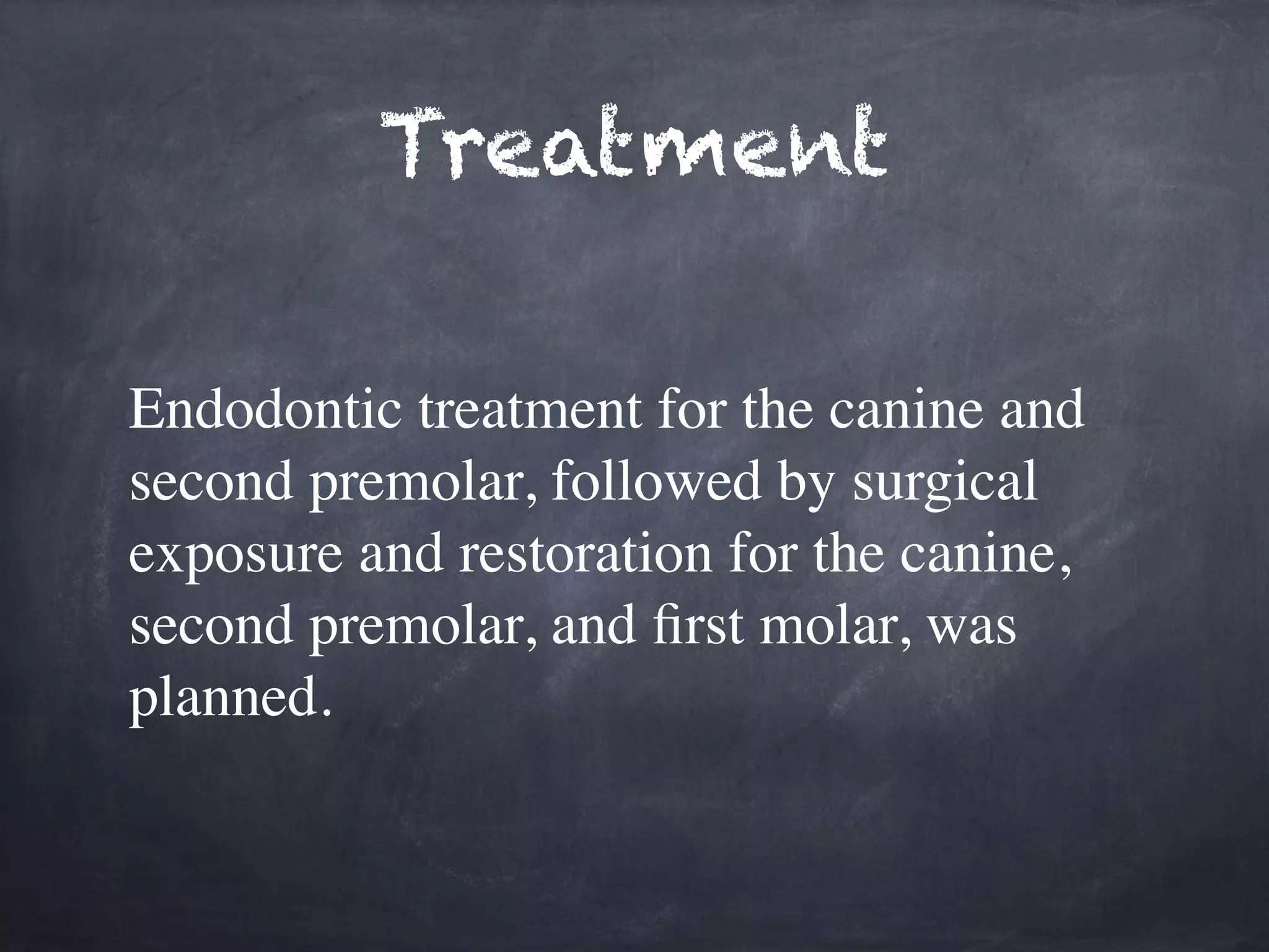 Treatment 
Endodontic treatment for the canine and 
second premolar, followed by surgical 
exposure and restoration for the canine, 
second premolar, and first molar, was 
planned. 
 