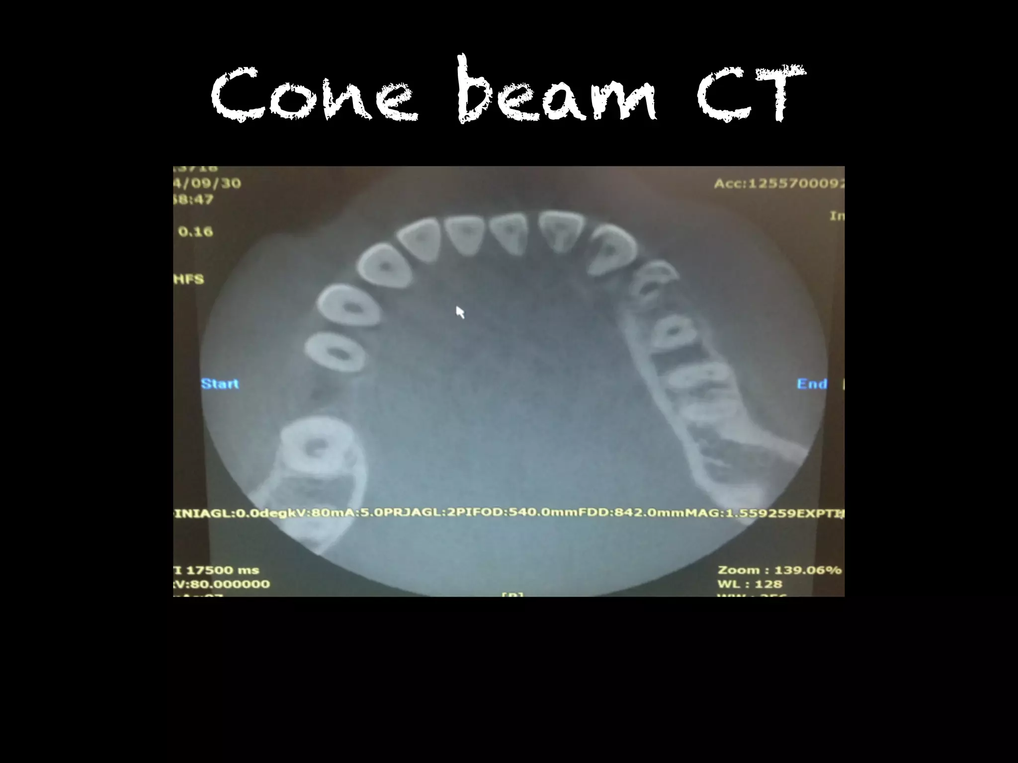 Cone beam CT 
 