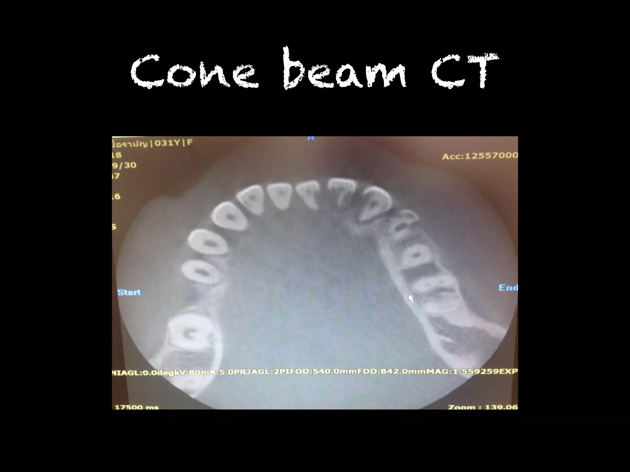 Cone beam CT 
 