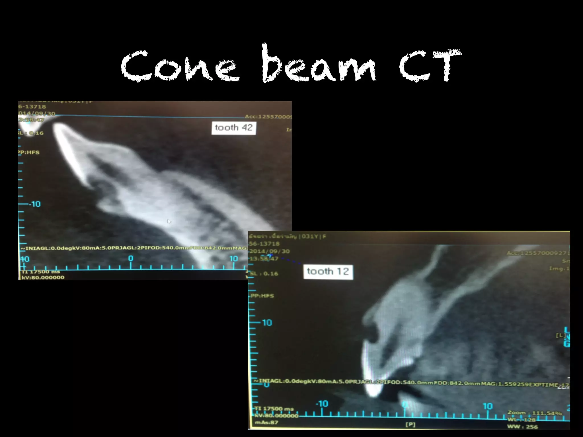 Cone beam CT 
 