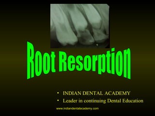 • INDIAN DENTAL ACADEMY
• Leader in continuing Dental Education
www.indiandentalacademy.com
 