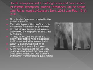  No episode of pain was reported by the
patient in tooth #8.
 The patient gave a history of trauma to
her anterior teeth about 15 years back.
 On clinical examination, tooth #8 was
discoloured and displayed an Ellis class
IV fracture.
 It failed to respond to thermal and
electric pulp testing while the adjacent
teeth responded within normal limits.
 Ca(OH)2 paste was placed as an
intracanal medicament for 1 week.
 At the next appointment, the Ca(OH)2
paste was flushed out; the canal was
dried and obturated with warm vertical
compaction technique using gutta-percha.
 