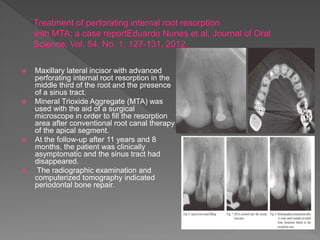  Maxillary lateral incisor with advanced
perforating internal root resorption in the
middle third of the root and the presence
of a sinus tract.
 Mineral Trioxide Aggregate (MTA) was
used with the aid of a surgical
microscope in order to fill the resorption
area after conventional root canal therapy
of the apical segment.
 At the follow-up after 11 years and 8
months, the patient was clinically
asymptomatic and the sinus tract had
disappeared.
 The radiographic examination and
computerized tomography indicated
periodontal bone repair.
 