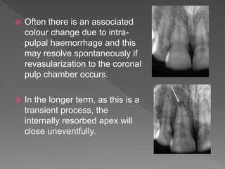  Often there is an associated
colour change due to intra-
pulpal haemorrhage and this
may resolve spontaneously if
revasularization to the coronal
pulp chamber occurs.
 In the longer term, as this is a
transient process, the
internally resorbed apex will
close uneventfully.
 