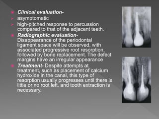  Clinical evaluation-
 asymptomatic
 high-pitched response to percussion
compared to that of the adjacent teeth.
 Radiographic evaluation-
Disappearance of the periodontal
ligament space will be observed, with
associated progressive root resorption,
followed by bone replacement. The defect
margins have an irregular appearance
 Treatment- Despite attempts at
treatment, such as placement of calcium
hydroxide in the canal, this type of
resorption usually progresses until there is
little or no root left, and tooth extraction is
necessary.
 