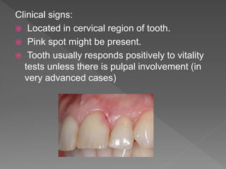 Clinical signs:
 Located in cervical region of tooth.
 Pink spot might be present.
 Tooth usually responds positively to vitality
tests unless there is pulpal involvement (in
very advanced cases)
 