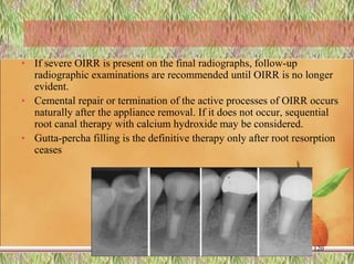 • If severe OIRR is present on the final radiographs, follow-up
radiographic examinations are recommended until OIRR is no longer
evident.
• Cemental repair or termination of the active processes of OIRR occurs
naturally after the appliance removal. If it does not occur, sequential
root canal therapy with calcium hydroxide may be considered.
• Gutta-percha filling is the definitive therapy only after root resorption
ceases
120
 