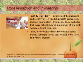 Root resorption and Invisalign®
• Gay G et al (2017) - investigated the incidence
and severity of RR in adult patients treated with
aligners during class I treatments. They evaluated
that every patient showed a minimum of one tooth
with root length reduction.
• They also concluded that Severe RR affected
mostly the upper lateral incisors and lower lateral
and central incisors.
Gay G et al. Root resorption during orthodontic treatment with Invisalign®: a radiometric study.Progress
in orthod 2017;18(12):1-9.
39
 