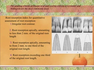 Root resorption index for quantitative
assessment of root resorption:
1.Irregular root contour.
2. Root resorption apically, amounting
to less than 2 mm. of the original root
length
3. Root resorption apically, amounting
to from 2 mm. to one third of the
original root length.
4. Root resorption exceeding one third
of the original root length.
81
The grading criteria of Sharpe et al and scoring criteria of Levander and
Malmgren are the most commonly used.
 