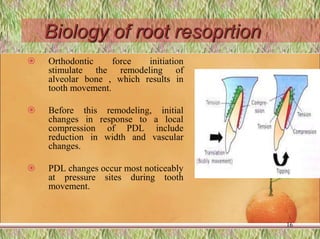 Biology of root resoprtion
 Orthodontic force initiation
stimulate the remodeling of
alveolar bone , which results in
tooth movement.
 Before this remodeling, initial
changes in response to a local
compression of PDL include
reduction in width and vascular
changes.
 PDL changes occur most noticeably
at pressure sites during tooth
movement.
16
 