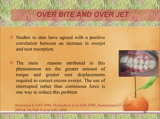  Studies to date have agreed with a positive
correlation between an increase in overjet
and root resorption.
 The main reasons attributed to this
phenomenon are the greater amount of
torque and greater root displacements
required to correct excess overjet. The use of
interrupted rather than continuous force is
one way to reduce this problem
56
Baumrind S AJO 1996, Horiuchi A et al AJO 1998 ,Sameshima GT, AJO
2001& McNab S et al AJO 2000
OVER BITE AND OVER JET
 