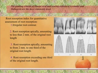 Root resorption index for quantitative
assessment of root resorption:
1.Irregular root contour.
2. Root resorption apically, amounting
to less than 2 mm. of the original root
length
3. Root resorption apically, amounting
to from 2 mm. to one third of the
original root length.
4. Root resorption exceeding one third
of the original root length.
81
The grading criteria of Sharpe et al and scoring criteria of Levander and
Malmgren are the most commonly used.
 